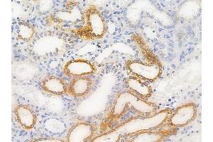 ABIN6256521 and ABIN6267628 at 1/100 staining human normal kidney tissue by IHC-P. (FOXO1 Antikörper  (pan, pThr24, pThr32))