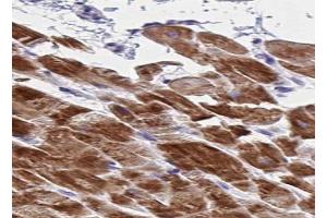 ABIN6266734 at 1/100 staining human skeletal muscle tissue sections by IHC-P. (Adenylate Kinase 1 Antikörper  (Internal Region))