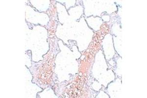 Immunohistochemical staining of rat lung tissue with REEP2 polyclonal antibody  at 5 ug/mL dilution. (REEP2 Antikörper)