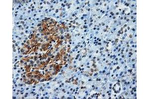 Immunohistochemistry (IHC) image for anti-ATP Synthase, H+ Transporting, Mitochondrial F1 Complex, beta Polypeptide (ATP5B) antibody (ABIN1496767) (ATP5B Antikörper)