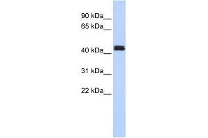 Western Blot showing TRAF1 antibody used at a concentration of 1-2 ug/ml to detect its target protein. (TRAF1 Antikörper  (Middle Region))