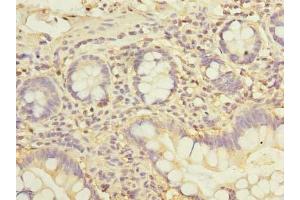 Immunohistochemistry of paraffin-embedded human small intestine tissue using ABIN7162542 at dilution of 1:100 (ZDHHC2 Antikörper  (AA 230-367))