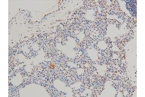 Immunohistochemistry (IHC) image for anti-LIM Domain Kinase 1 (LIMK1) (pThr508) antibody (ABIN6255701)