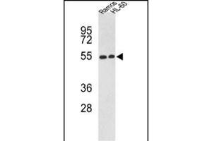 Western blot analysis of NR1H2 Antibody (N-term) (ABIN652465 and ABIN2842316) in Ramos, HL-60 cell line lysates (35 μg/lane). (NR1H2 Antikörper  (N-Term))