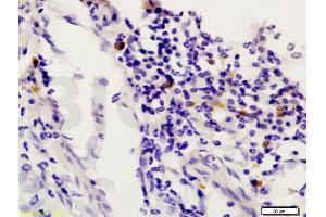 Formalin-fixed and paraffin embedded rat uterus labeled with Anti-STAT6 Polyclonal Antibody, Unconjugated (ABIN738291) at 1:200 followed by conjugation to the secondary antibody and DAB staining. (STAT6 Antikörper  (AA 601-700))