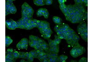 Anti-POR mouse monoclonal antibody (ABIN2453490) immunofluorescent staining of COS7 cells transiently transfected by pCMV6-ENTRY POR (RC202172). (POR Antikörper)