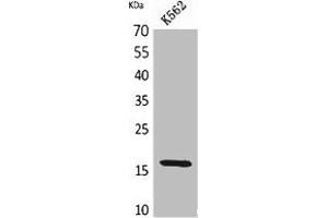 Western Blot analysis of K562 cells using CRBP II Polyclonal Antibody. (RBP2 Antikörper  (Internal Region))