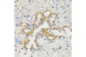 Immunohistochemistry of paraffin-embedded rat kidney using SH2B1 Antibody (ABIN1876744) at dilution of 1:100 (40x lens). (SH2B1 Antikörper)