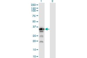 Western Blot analysis of APTX expression in transfected 293T cell line by APTX monoclonal antibody (M02), clone 2H6.