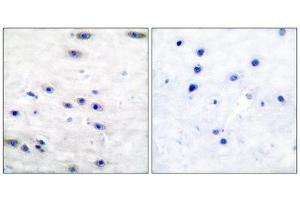 Immunohistochemistry (IHC) image for anti-Tyrosine Hydroxylase (TH) (Ser19) antibody (ABIN1847900) (Tyrosine Hydroxylase Antikörper  (Ser19))