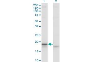Western Blot analysis of CRH expression in transfected 293T cell line by CRH monoclonal antibody (M02), clone 2B11. (CRH Antikörper  (AA 154-196))