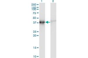 Western Blotting (WB) image for anti-Actin-Related Protein T2 (ACTRT2) (AA 209-300) antibody (ABIN599611) (ACTRT2 Antikörper  (AA 209-300))