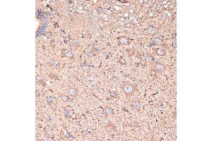 Immunohistochemistry of paraffin-embedded mouse spinal cord using GABA transaminase (GABA transaminase (ABAT)) Rabbit mAb (ABIN7265336) at dilution of 1:100 (40x lens). (ABAT Antikörper)