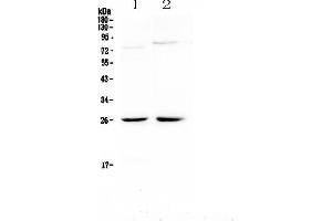 Western blot analysis of NMU using anti-NMU antibody . (Neuromedin U Antikörper)