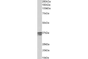 ABIN5539506 (0. (TNNT1 Antikörper  (Internal Region))