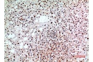 Immunohistochemistry (IHC) analysis of paraffin-embedded Human Liver, antibody was diluted at 1:100. (BCL6 Antikörper  (Internal Region))