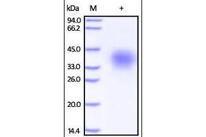 Human TRAIL R4, His Tag on SDS-PAGE under reducing (R) condition. (DcR2 Protein (AA 56-211) (His tag))