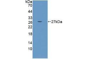 Detection of recombinant CRAT using Polyclonal Antibody to Carnitine Acetyltransferase (CRAT) (CRAT Antikörper  (AA 55-256))