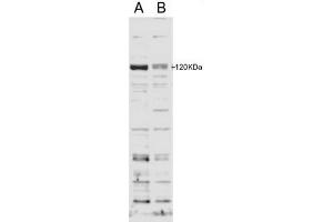 Image no. 2 for anti-SECIS Binding Protein 2 (SECISBP2) (Internal Region) antibody (ABIN374739) (SECISBP2 Antikörper  (Internal Region))