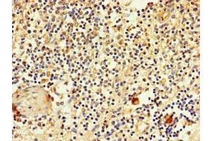 Immunohistochemistry of paraffin-embedded human spleen tissue using ABIN7170119 at dilution of 1:100 (SLC2A3 Antikörper  (AA 205-269))