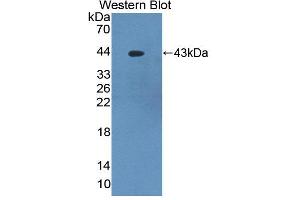 Figure. (PKC delta Antikörper  (AA 330-672))