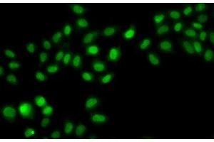 Immunofluorescence analysis of A549 cells using SULT2B1 Polyclonal Antibody (SULT2B1 Antikörper)