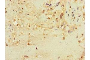 Immunohistochemistry of paraffin-embedded human placenta tissue using ABIN7171870 at dilution of 1:100 (TSPAN32 Antikörper  (AA 111-202))