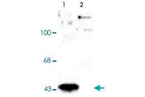 Western blot of human T-47D cells showing specific immunolabeling of the ~45k MAP2K1 (Control). (MEK1 Antikörper  (pThr386))