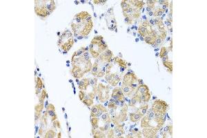 Immunohistochemistry (Paraffin-embedded Sections) (IHC (p)) image for anti-Glutaminase (GLS) (AA 610-669) antibody (ABIN1680034)