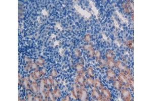 Used in DAB staining on fromalin fixed paraffin- embedded kidney tissue (ATM Antikörper  (AA 486-742))