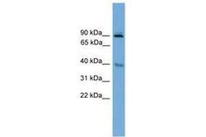 Image no. 1 for anti-L(3)mbt-Like 1 (L3MBTL1) (AA 221-270) antibody (ABIN6744661)