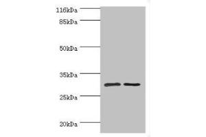 Western blot All lanes: SRPRB antibody at 2 μg/mL Lane 1: HepG2 whole cell lysate Lane 2: Hela whole cell lysate Secondary Goat polyclonal to rabbit IgG at 1/10000 dilution Predicted band size: 30 kDa Observed band size: 30 kDa (SRPRB Antikörper  (AA 58-271))