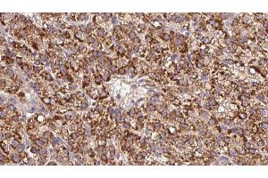 Immunohistochemistry (IHC) image for anti-Cholinergic Receptor, Nicotinic, beta 3 (Neuronal) (CHRNB3) (Internal Region) antibody (ABIN6260826)