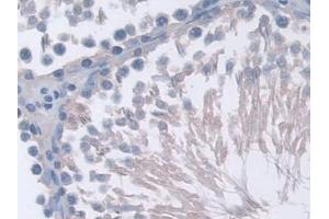 anti-Protein Phosphatase 2A Activator, Regulatory Subunit 4 (PPP2R4) (AA 1-323) antibody