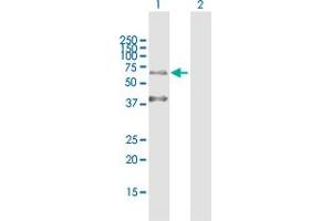 Western Blot analysis of KRT9 expression in transfected 293T cell line by KRT9 MaxPab polyclonal antibody.