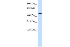 WB Suggested Anti-HSP90B1 Antibody Titration:  1. (GRP94 Antikörper  (N-Term))