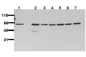 Western Blotting (WB) image for anti-V-Akt Murine Thymoma Viral Oncogene Homolog 2 (AKT2) antibody (ABIN126856) (AKT2 Antikörper)