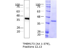 Western Blotting (WB) image for Transmembrane Protein 173 (TMEM173) (AA 1-379) protein (rho-1D4 tag) (ABIN3116214)