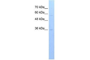 WB Suggested Anti-RFPL3 Antibody Titration:  0. (RFPL3 Antikörper  (C-Term))
