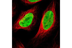 Immunofluorescent staining of human cell line U-2 OS with HDAC2 polyclonal antibody  shows positivity in nucleus. (HDAC2 Antikörper  (AA 415-488))