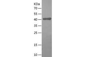 Western Blotting (WB) image for Glutamic-Oxaloacetic Transaminase 2, Mitochondrial (Aspartate Aminotransferase 2) (GOT2) (AA 2-413) protein (His tag) (ABIN7123118)