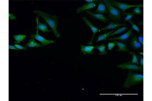 Immunofluorescence of purified MaxPab antibody to SNRPB on HeLa cell. (SNRPB Antikörper  (AA 1-240))
