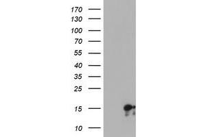 Western Blotting (WB) image for anti-Synaptojanin 2 Binding Protein (SYNJ2BP) antibody (ABIN1501272) (SYNJ2BP Antikörper)