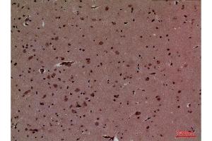 Immunohistochemistry (IHC) image for anti-Homeobox D3 (HOXD3) (Internal Region) antibody (ABIN3187731)