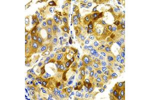 Immunohistochemistry (IHC) image for anti-Cyclin-Dependent Kinase 20 (CDK20) antibody (ABIN3016460) (CCRK Antikörper)