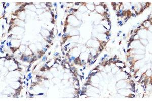 Immunohistochemistry of paraffin-embedded Human colon using HSPA1A Monoclonal Antibody at dilution of 1:100 (40x lens). (HSP70 1A Antikörper)