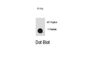 Dot blot analysis of anti-Phospho-YES1-/Phospho-SRC- Antibody (ABIN389661 and ABIN2850452) on nitrocellulose membrane. (YES1/SRC (pTyr530) Antikörper)