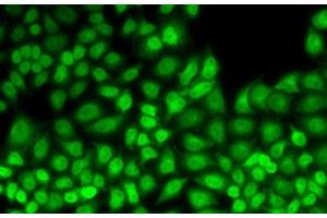 Immunofluorescence analysis of HeLa cells using JUNB Polyclonal Antibody (JunB Antikörper)