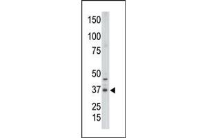 Western Blotting (WB) image for anti-Caudal Type Homeobox 2 (CDX2) (AA 1-30), (N-Term) antibody (ABIN390076)
