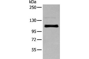 Western blot analysis of A549 cell using ZNF281 Polyclonal Antibody at dilution of 1:250 (ZNF281 Antikörper)
